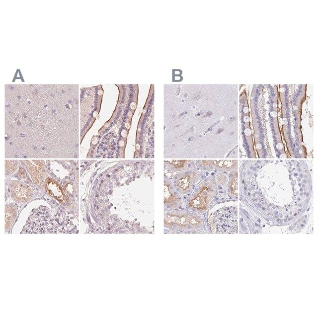 Anti-TREH antibody produced in rabbit