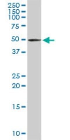 Anti-TRDMT1 antibody produced in rabbit