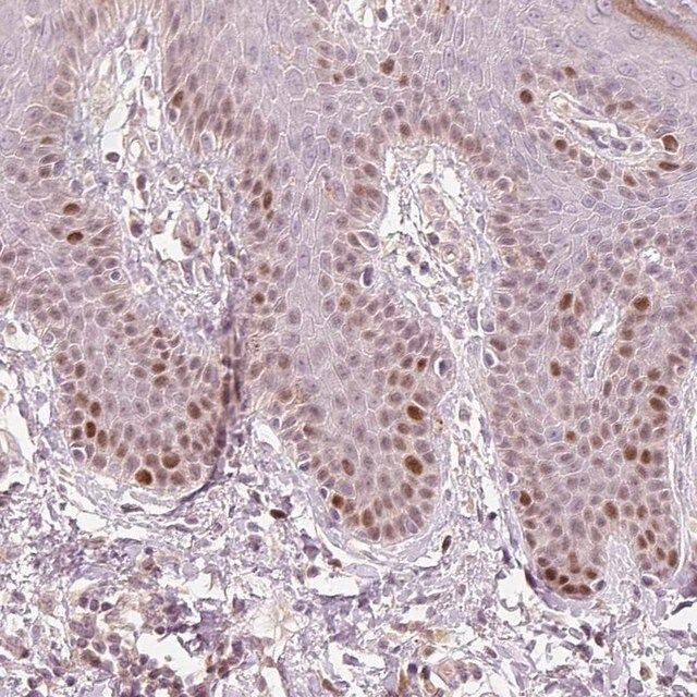 Anti-TREX2 antibody produced in rabbit