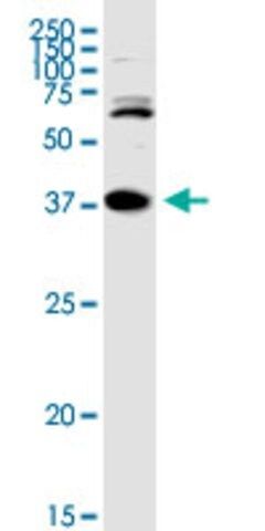 Anti-TREX1 antibody produced in rabbit