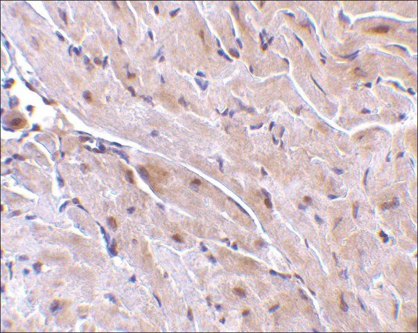 Anti-TRIAD3A antibody produced in rabbit