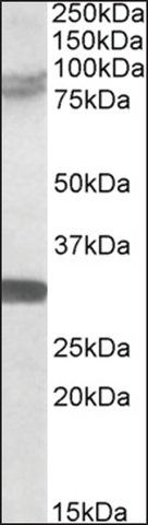 Anti-TRIM2 (C-terminal) antibody produced in goat