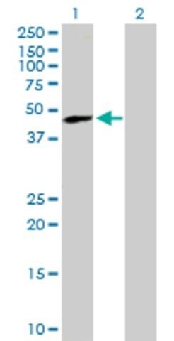 Anti-TREX1 antibody produced in mouse