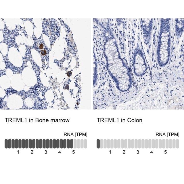 Anti-TREML1 antibody produced in rabbit