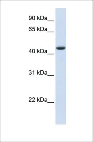 Anti-TRDMT1 antibody produced in rabbit