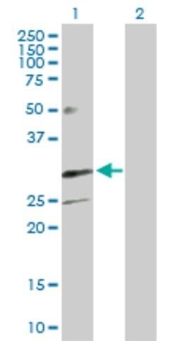 Anti-TREM1 antibody produced in rabbit