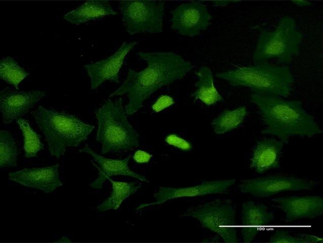 Anti-TRGV3 antibody produced in mouse