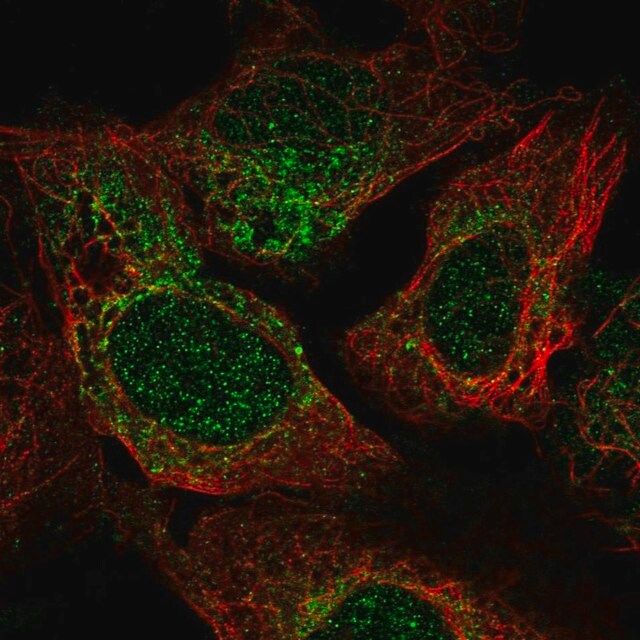 Anti-TRAPPC2 antibody produced in rabbit