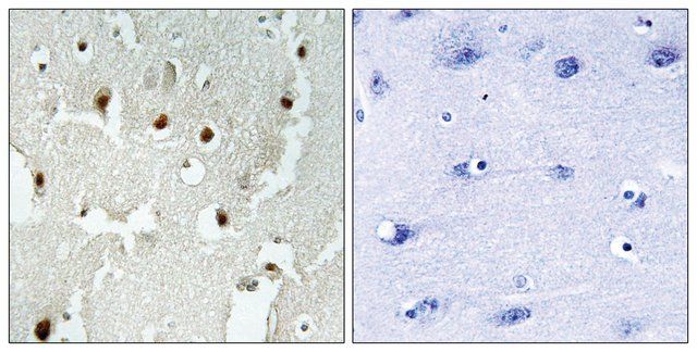 Anti-TREF1 antibody produced in rabbit