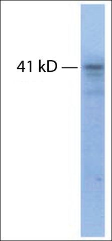 Anti-TRHR antibody produced in rabbit