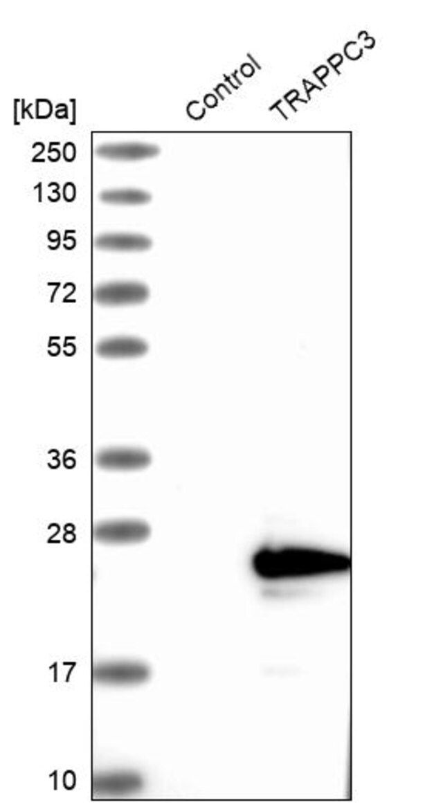 Anti-TRAPPC3 antibody produced in rabbit