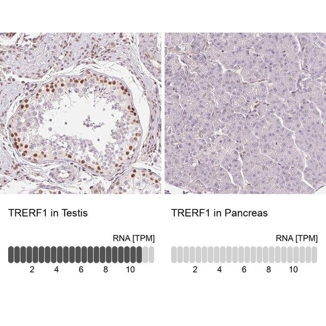 Anti-TRERF1 antibody produced in rabbit