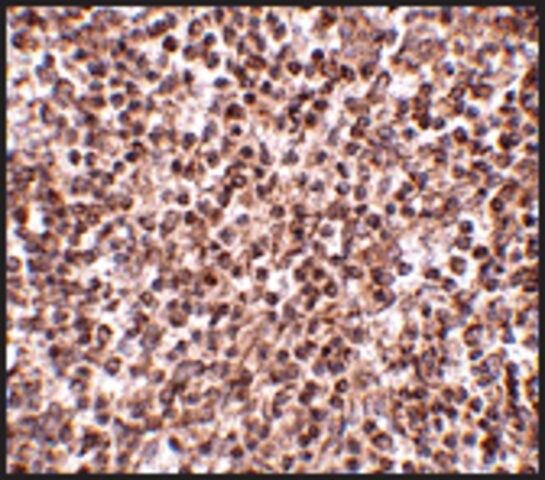 Anti-TREX1 antibody produced in rabbit