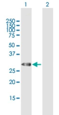 Anti-TRH antibody produced in mouse