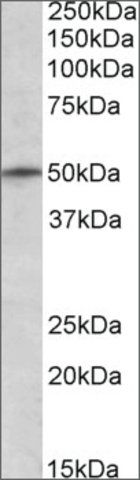 Anti-TRIM35 (N-terminal) antibody produced in goat