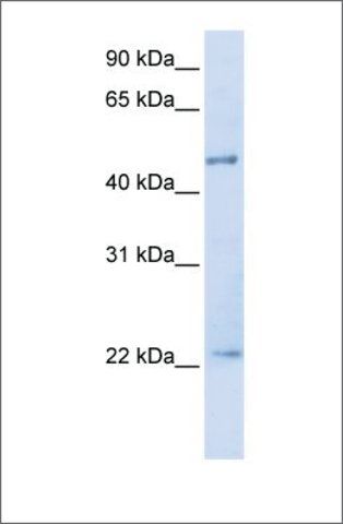 Anti-TRIM21 antibody produced in rabbit