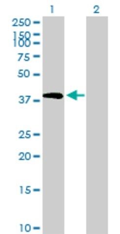 Anti-TRIB2 antibody produced in mouse