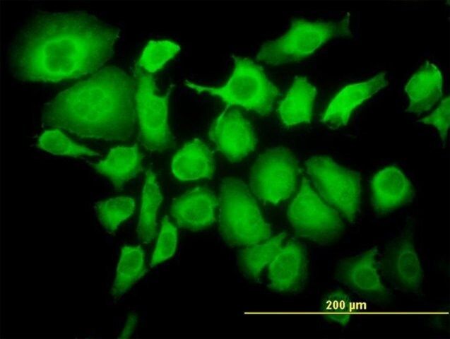 ANTI-TRIM25 antibody produced in mouse