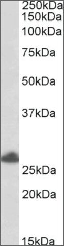 Anti-TRIM40 (C-terminal) antibody produced in goat