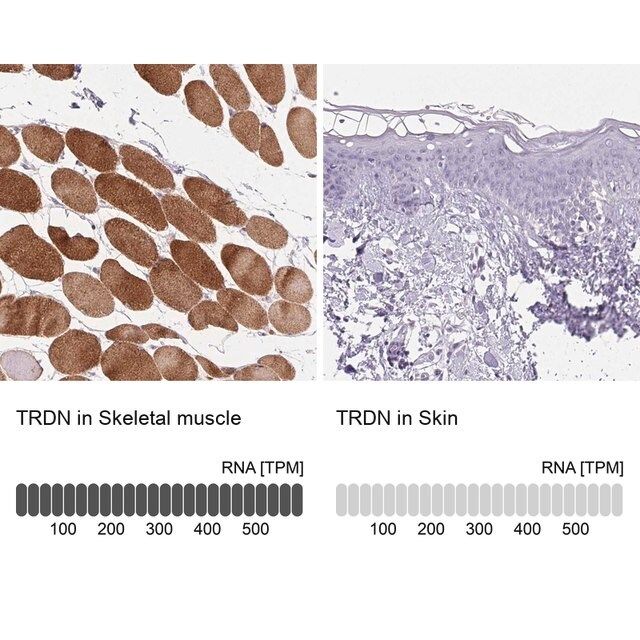 Anti-TRDN antibody produced in rabbit