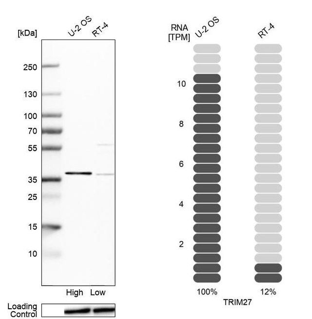 Anti-TRIM27 antibody produced in rabbit