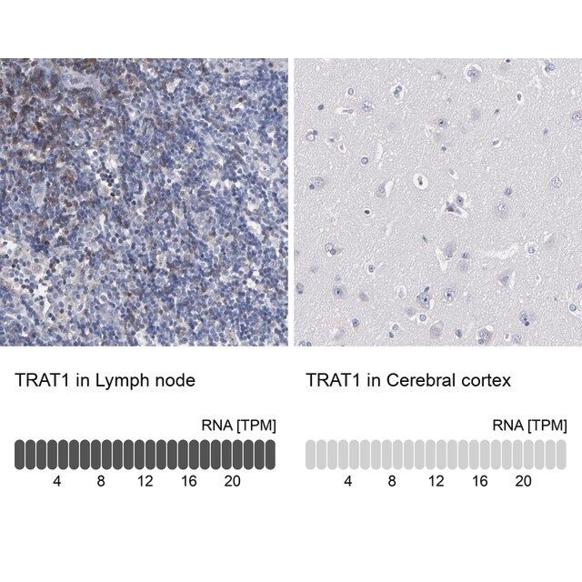 Anti-TRAT1 antibody produced in rabbit