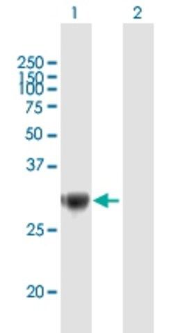 Anti-TRIM72 antibody produced in mouse