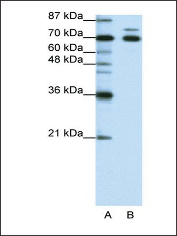 Anti-TRIM16 antibody produced in rabbit