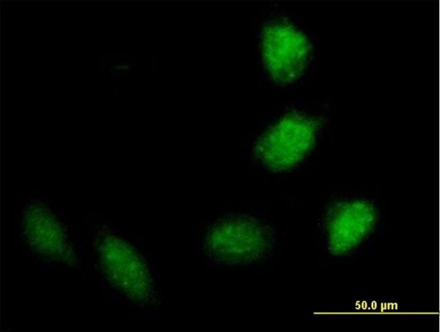 Anti-TRIM40 antibody produced in mouse