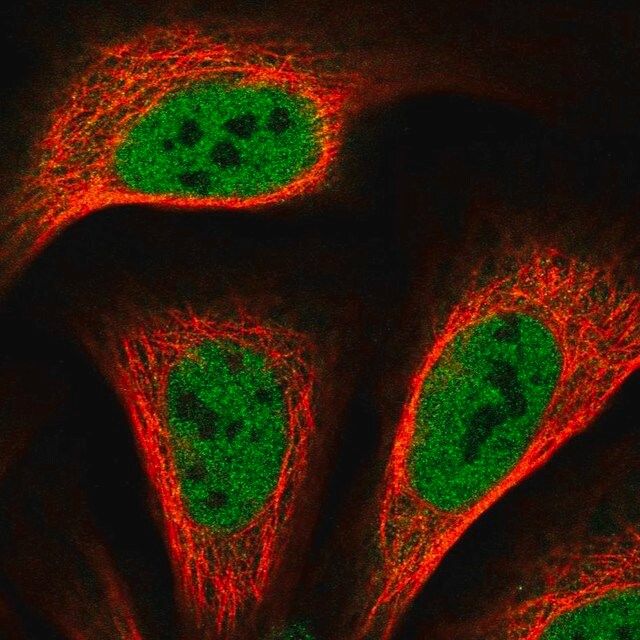 Anti-TRERF1 antibody produced in rabbit