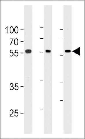 ANTI-TRIM6 (N-TERMINAL) antibody produced in rabbit