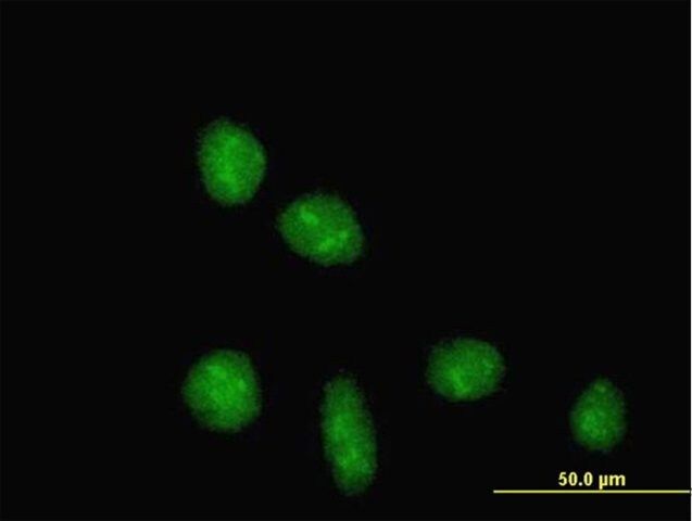 Anti-TRIM28 antibody produced in mouse