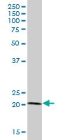 Anti-TRIM48 antibody produced in mouse