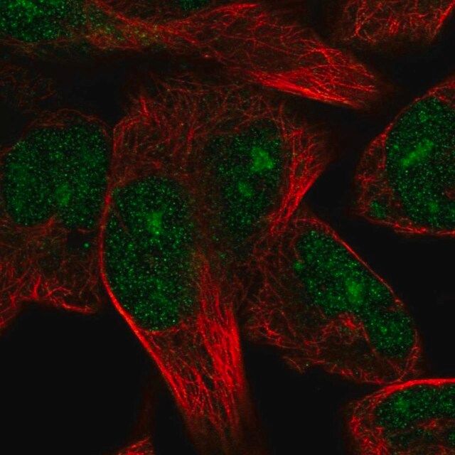 Anti-TRIM72 antibody produced in rabbit