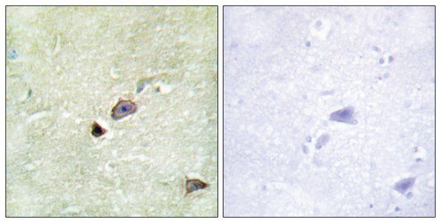 Anti-TRIM59 antibody produced in rabbit