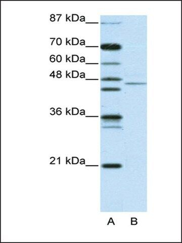 Anti-TRIM14 antibody produced in rabbit