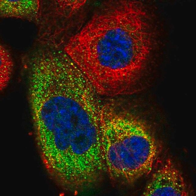 Anti-TRIM73 antibody produced in rabbit