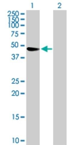 Anti-TRIM47 antibody produced in mouse