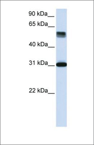 Anti-TRIM31 antibody produced in rabbit