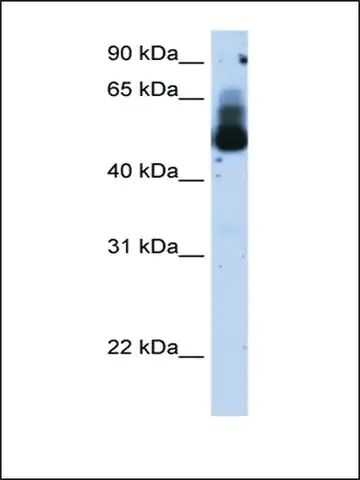 Anti-TRIM21 antibody produced in rabbit