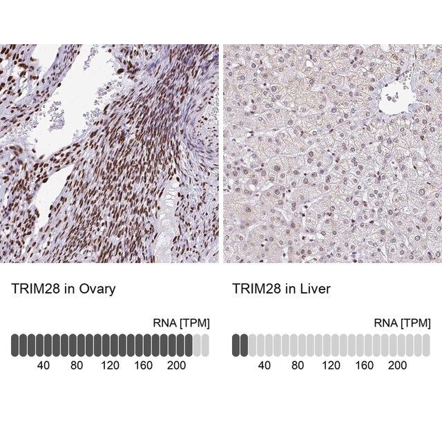 Anti-TRIM28 antibody produced in rabbit