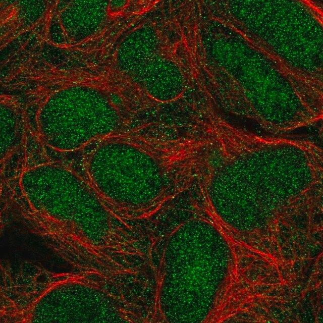 Anti-TRIM11 antibody produced in rabbit