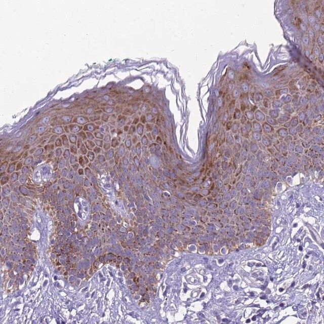 Anti-TRIM51 antibody produced in rabbit