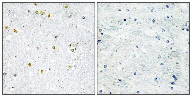 Anti-TRIM24 antibody produced in rabbit