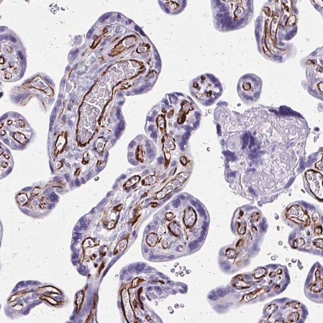 Anti-TRIM6 antibody produced in rabbit