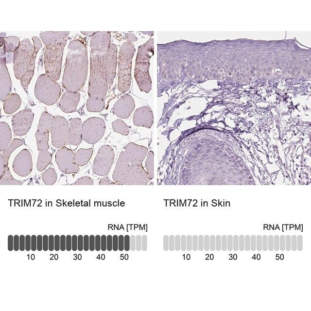 Anti-TRIM72 antibody produced in rabbit