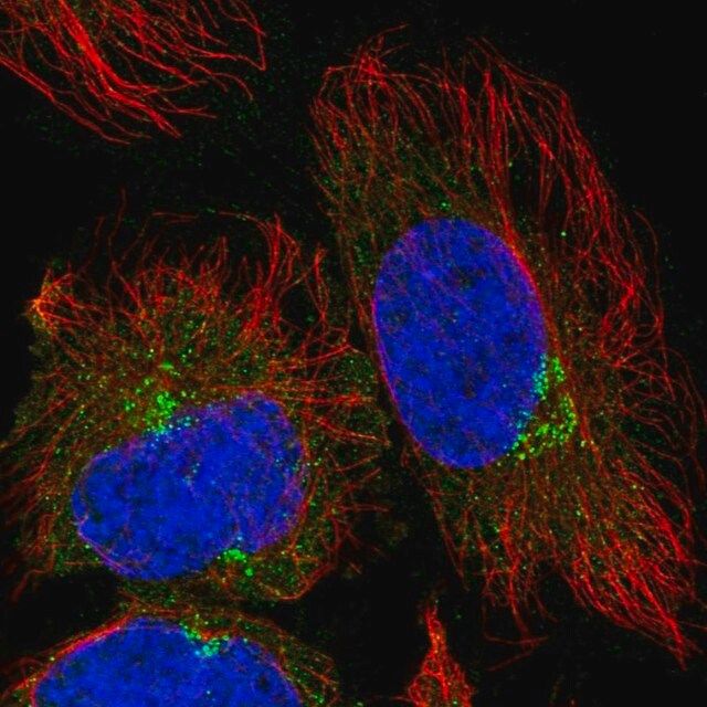 Anti-TRIM44 antibody produced in rabbit