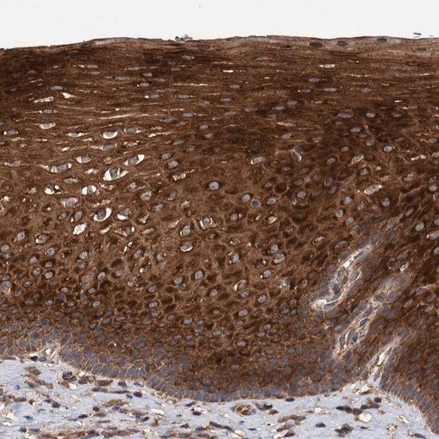 Anti-TRIM16 antibody produced in rabbit