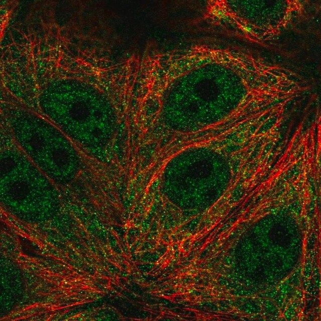 Anti-TRIM65 antibody produced in rabbit