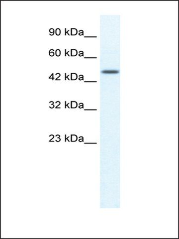 Anti-TRIM39 antibody produced in rabbit